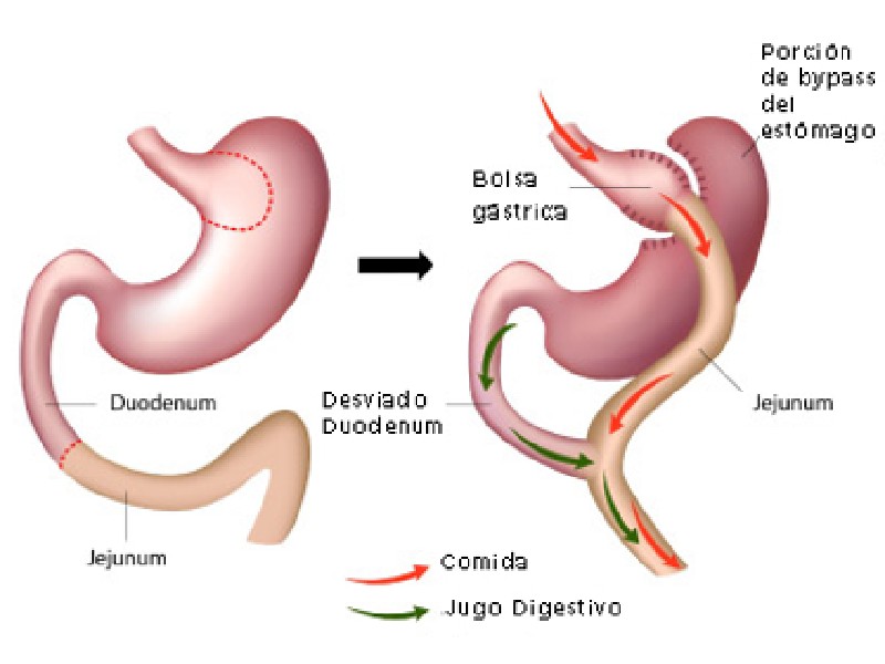 Cirujano Obesidad Cirugia Metabolica Quito Dra Marta Cueva1-min Cirujano Obesidad Cirugia Metabolica Quito Dra Marta Cueva1-min