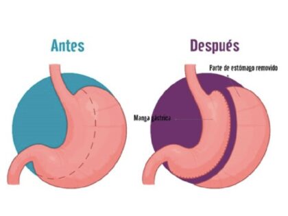 Cirujano Obesidad Cirugia Metabolica Quito Dra Marta Cueva2-min Cirujano Obesidad Cirugia Metabolica Quito Dra Marta Cueva2-min