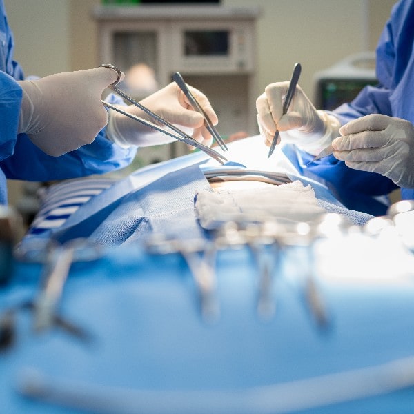 Peritonitis que es tratamiento quito1-min
